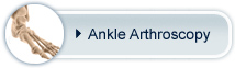 Ankle Arthroscopy